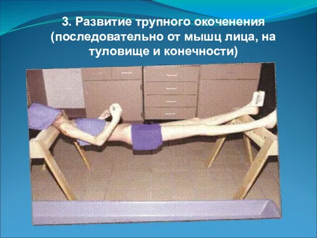 3. Развитие трупного окоченения (последовательно от мышц лица, на туловище и конечности)