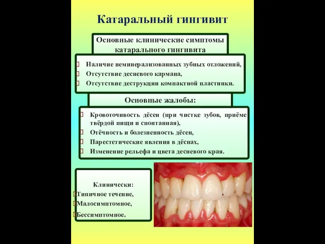 Катаральный гингивит Основные клинические симптомы катарального гингивита Кровоточивость дёсен (при чистке зубов, приёме