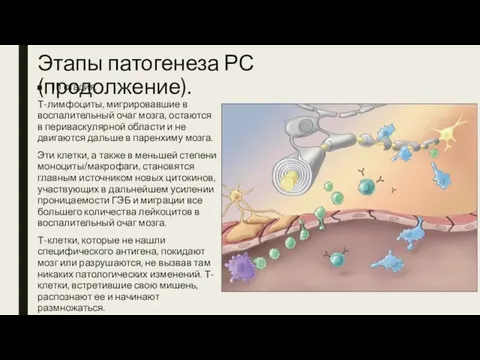 Этапы патогенеза РС (продолжение). III стадия. Т-лимфоциты, мигрировавшие в воспалительный