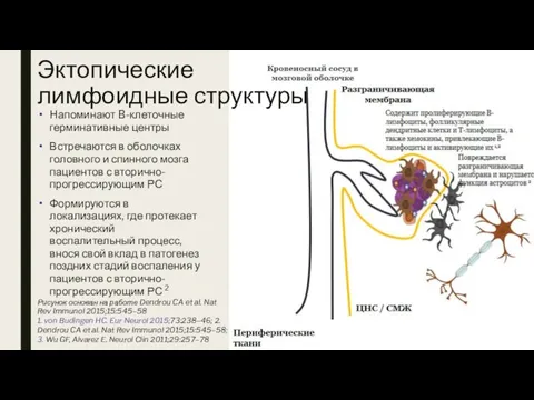 Эктопические лимфоидные структуры Напоминают B-клеточные герминативные центры Встречаются в оболочках