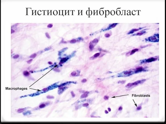 Гистиоцит и фибробласт