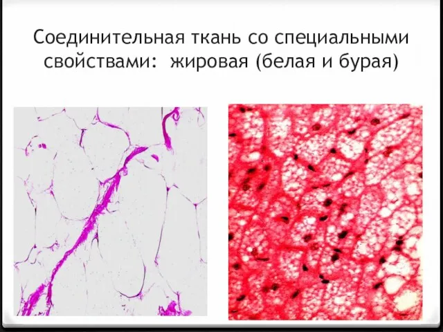 Соединительная ткань со специальными свойствами: жировая (белая и бурая)