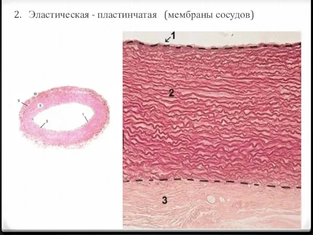 2. Эластическая - пластинчатая (мембраны сосудов)