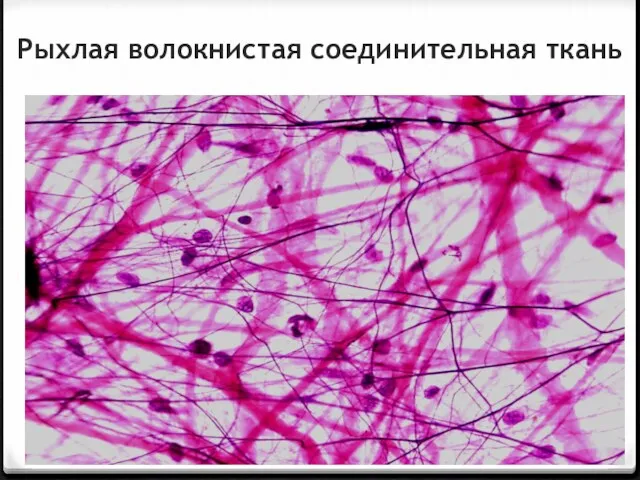 Рыхлая волокнистая соединительная ткань