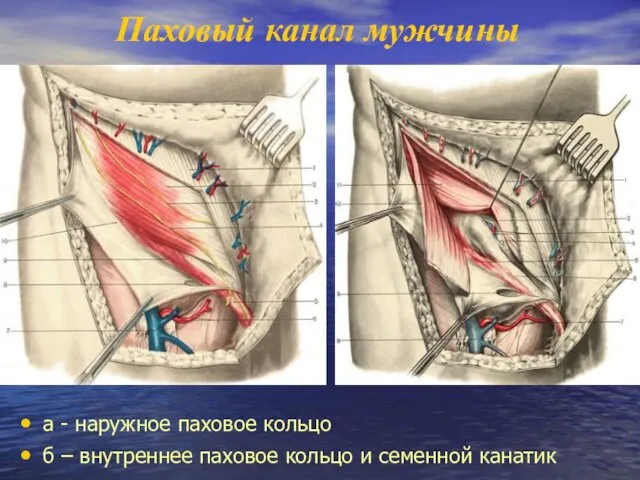 Паховый канал мужчины а - наружное паховое кольцо б – внутреннее паховое кольцо и семенной канатик