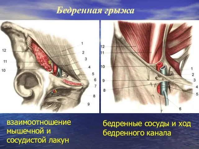 Бедренная грыжа взаимоотношение мышечной и сосудистой лакун бедренные сосуды и ход бедренного канала