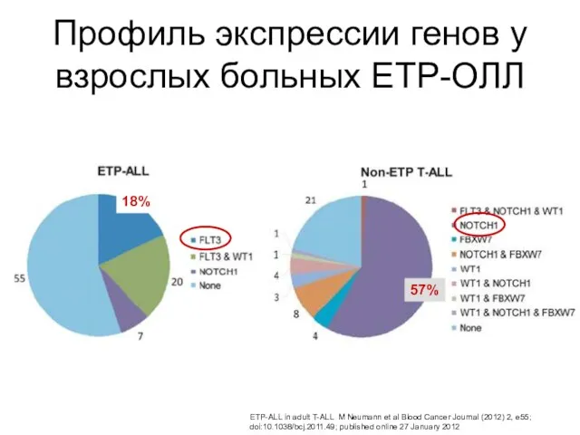 Профиль экспрессии генов у взрослых больных ETP-ОЛЛ ETP-ALL in adult