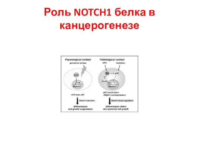 Роль NOTCH1 белка в канцерогенезе