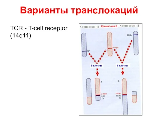 Варианты транслокаций TCR - T-cell receptor (14q11)