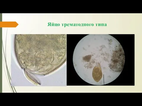 Яйцо трематодного типа