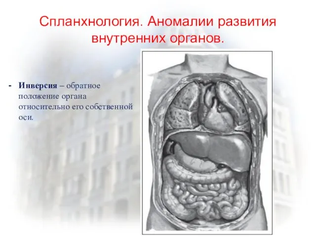 Спланхнология. Аномалии развития внутренних органов. Инверсия – обратное положение органа относительно его собственной оси.