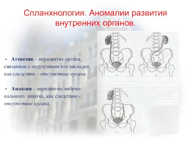 Спланхнология. Аномалии развития внутренних органов. Агенезия – неразвитие органа, связанное