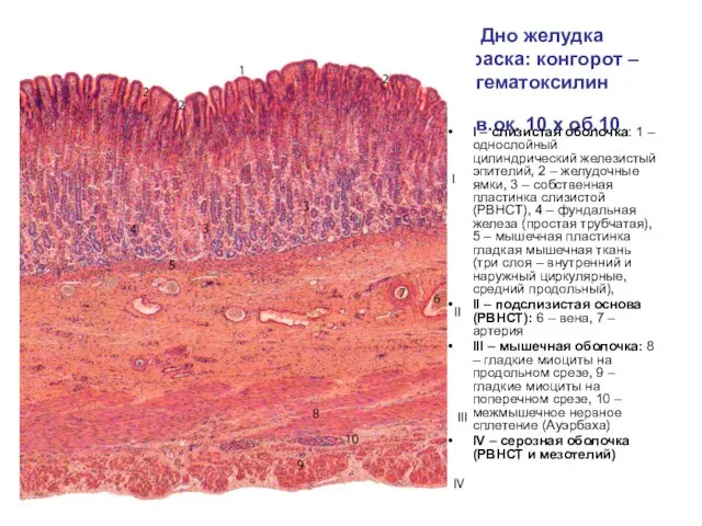Дно желудка Окраска: конгорот – гематоксилин Ув.ок. 10 х об.10 I – слизистая