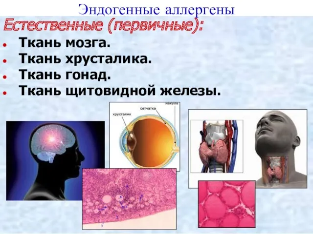 Эндогенные аллергены Естественные (первичные): Ткань мозга. Ткань хрусталика. Ткань гонад. Ткань щитовидной железы.