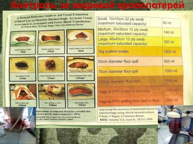 Контроль за видимой кровопотерей