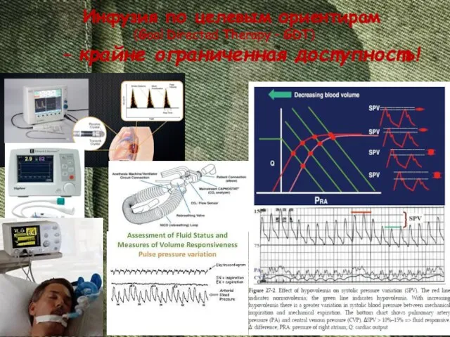 Инфузия по целевым ориентирам (Goal Directed Therapy – GDT) – крайне ограниченная доступность!