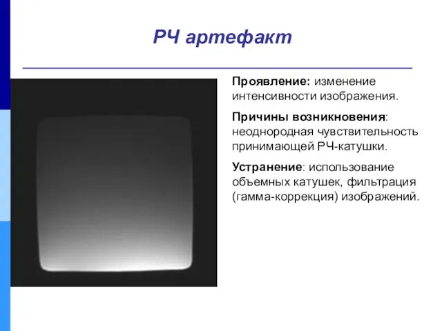 Проявление: изменение интенсивности изображения. Причины возникновения: неоднородная чувствительность принимающей РЧ-катушки.