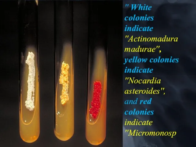 '' White colonies indicate ''Actinomadura madurae'', yellow colonies indicate ''Nocardia asteroides'', and red colonies indicate ''Micromonosp