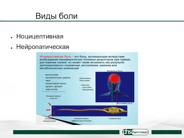 Виды боли Ноцицептивная Нейропатическая