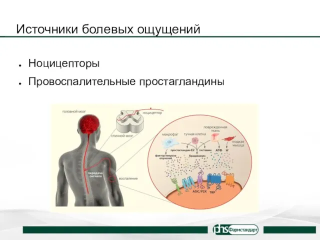 Источники болевых ощущений Ноцицепторы Провоспалительные простагландины