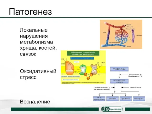 Патогенез Локальные нарушения метаболизма хряща, костей, связок Оксидативный стресс Воспаление