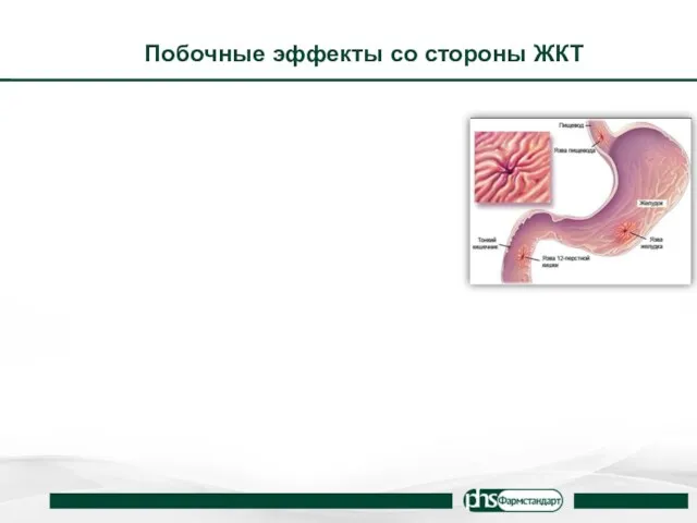 Побочные эффекты со стороны ЖКТ