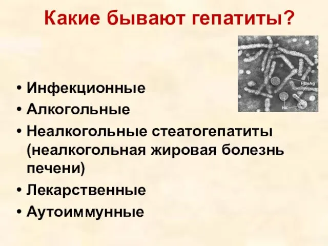 Какие бывают гепатиты? Инфекционные Алкогольные Неалкогольные стеатогепатиты (неалкогольная жировая болезнь печени) Лекарственные Аутоиммунные