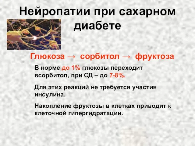 Нейропатии при сахарном диабете Глюкоза → сорбитол → фруктоза В