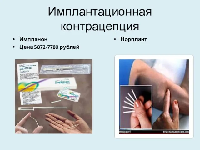 Имплантационная контрацепция Импланон Цена 5872-7780 рублей Норплант