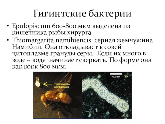 Гигинтские бактерии Epulopiscum 600-800 мкм выделена из кишечника рыбы хирурга.