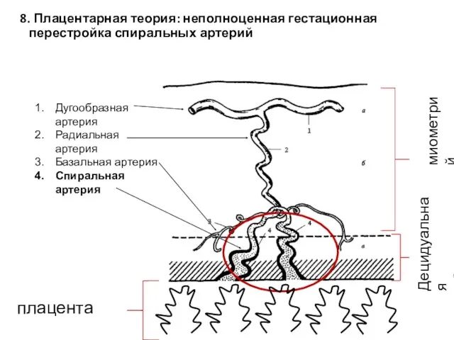 8. Плацентарная теория: неполноценная гестационная перестройка спиральных артерий Дугообразная артерия