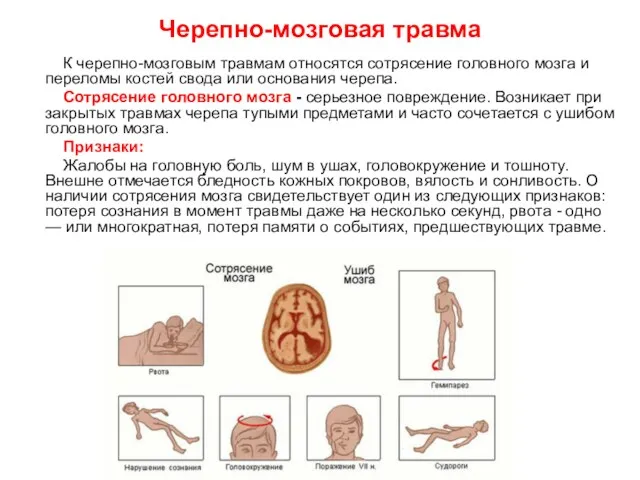 Черепно-мозговая травма К черепно-мозговым травмам относятся сотрясение головного мозга и