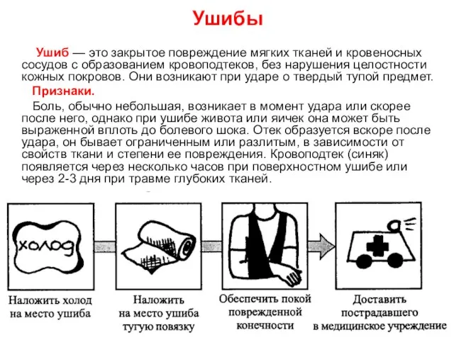 Ушибы Ушиб — это закрытое повреждение мягких тканей и кровеносных