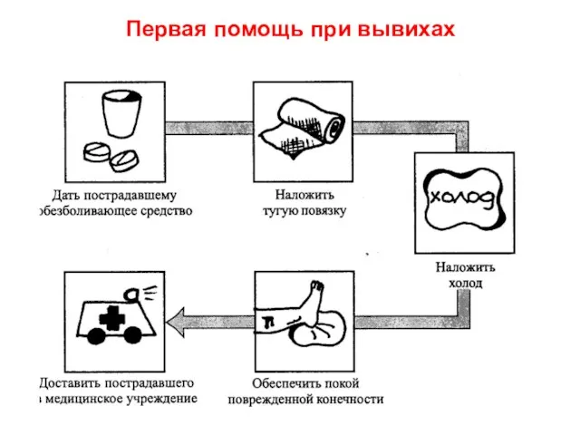 Первая помощь при вывихах