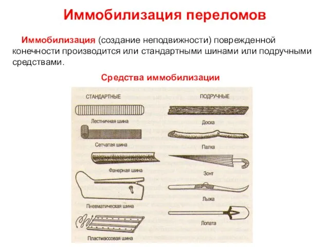 Иммобилизация переломов Иммобилизация (создание неподвижности) поврежденной конечности производится или стандартными шинами или подручными средствами. Средства иммобилизации