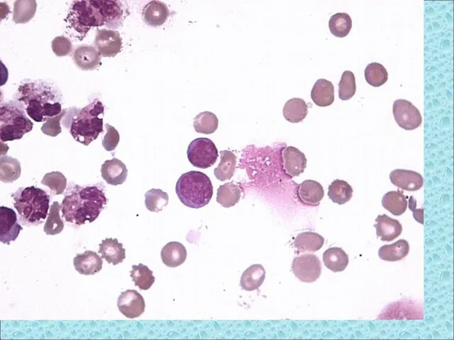 Лимфоциты. Ув.1000х. Азур-эозин