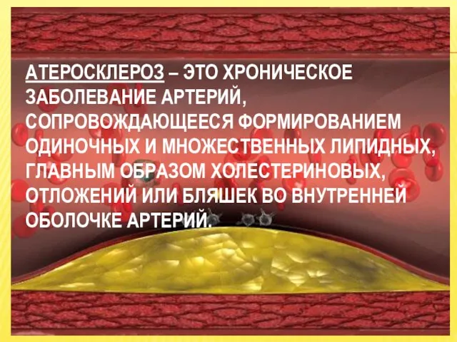 АТЕРОСКЛЕРОЗ – ЭТО ХРОНИЧЕСКОЕ ЗАБОЛЕВАНИЕ АРТЕРИЙ, СОПРОВОЖДАЮЩЕЕСЯ ФОРМИРОВАНИЕМ ОДИНОЧНЫХ И