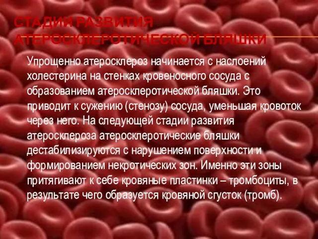 СТАДИИ РАЗВИТИЯ АТЕРОСКЛЕРОТИЧЕСКОЙ БЛЯШКИ Упрощенно атеросклероз начинается с наслоений холестерина