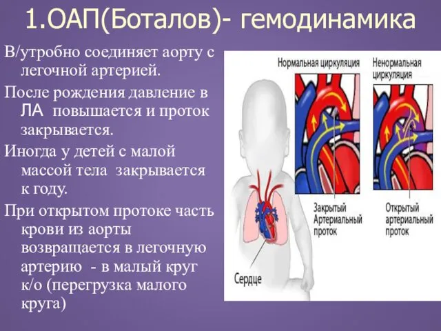 1.ОАП(Боталов)- гемодинамика В/утробно соединяет аорту с легочной артерией. После рождения