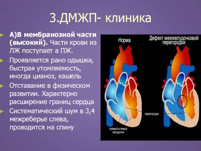 3.ДМЖП- клиника А)В мембранозной части (высокий). Части крови из ЛЖ