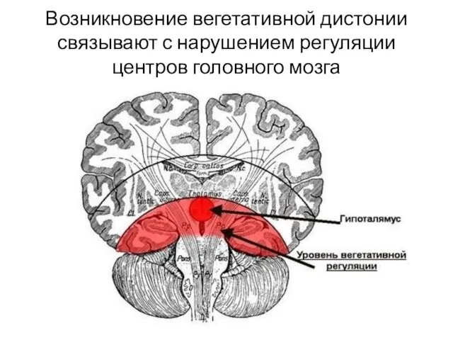 Возникновение вегетативной дистонии связывают с нарушением регуляции центров головного мозга