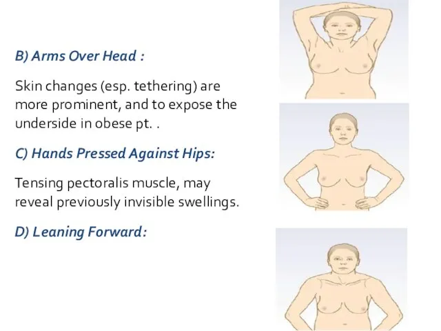 B) Arms Over Head : Skin changes (esp. tethering) are