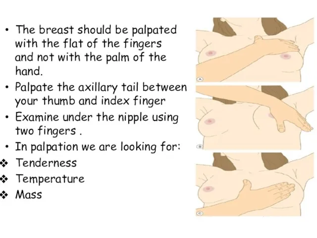 The breast should be palpated with the flat of the