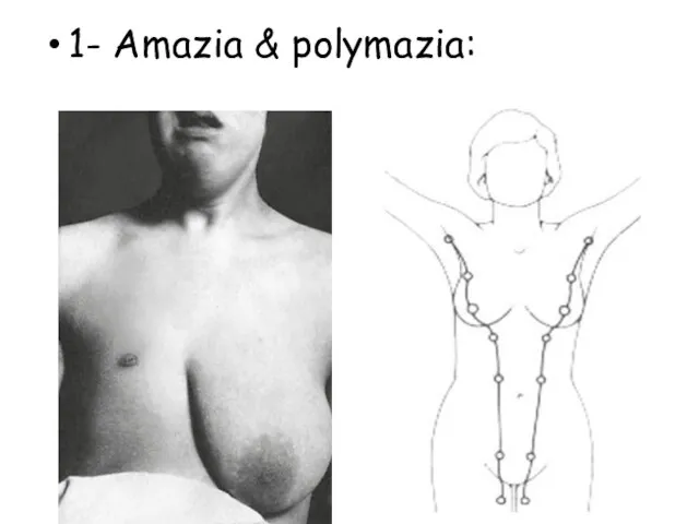 1- Amazia & polymazia: