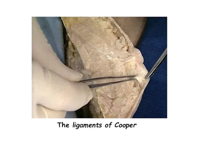 The ligaments of Cooper