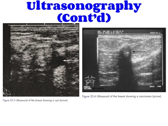 Ultrasonography (Cont’d)