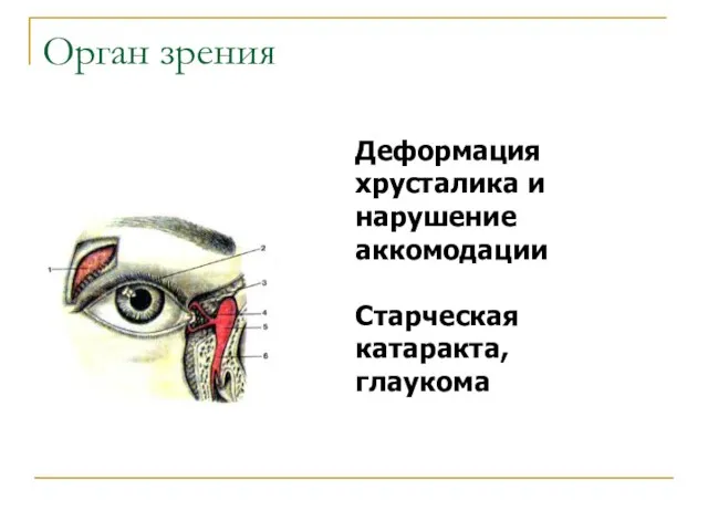 Орган зрения Деформация хрусталика и нарушение аккомодации Старческая катаракта, глаукома