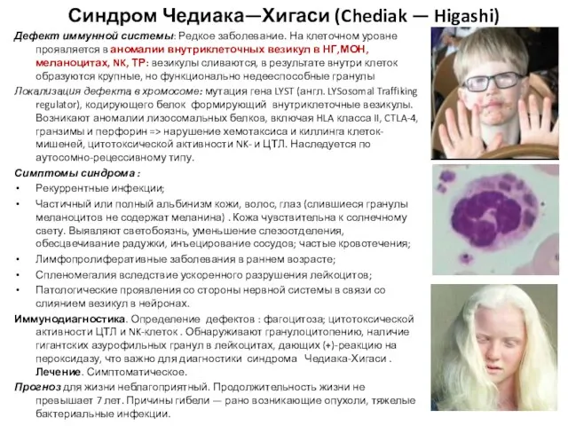 Синдром Чедиака—Хигаси (Chediak — Higashi) Дефект иммунной системы: Редкое заболевание. На клеточном уровне