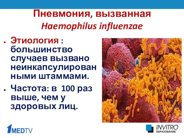 Пневмония, вызванная Haemophilus influenzae Этиология : большинство случаев вызвано неинкапсулированными
