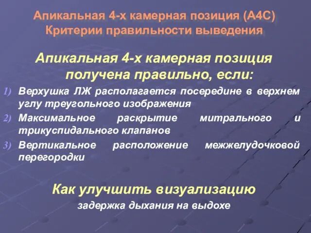 Апикальная 4-х камерная позиция (А4С) Критерии правильности выведения Апикальная 4-х